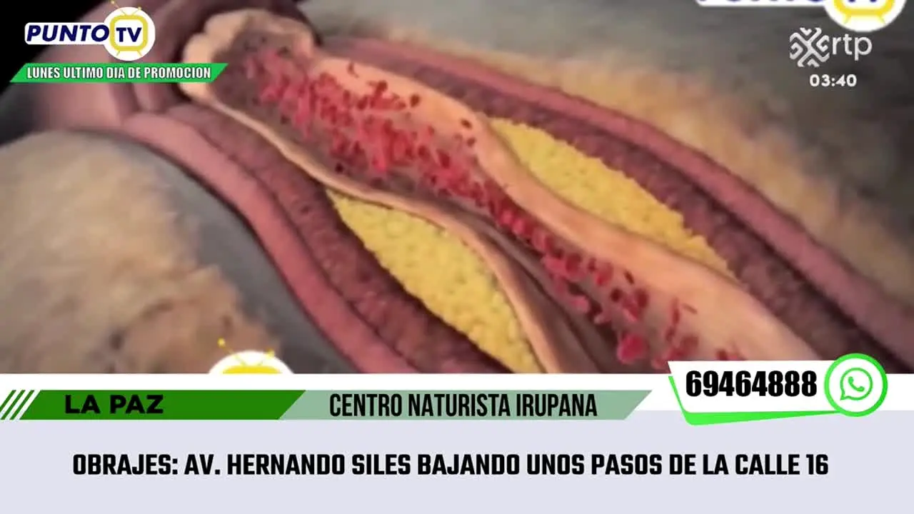 RTP live