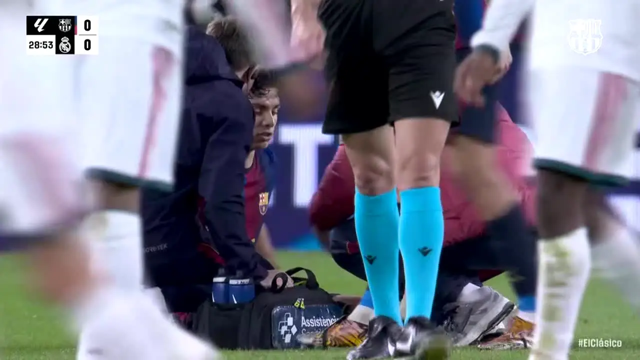 TOP Barça in diretta